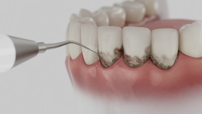 Reliable Dental Implants contractor in Manito, IL by Smile Center Dentistry